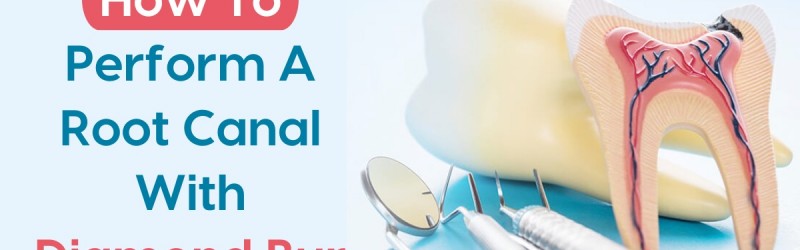 How To-Perform A Root Canal With Diamond Bur